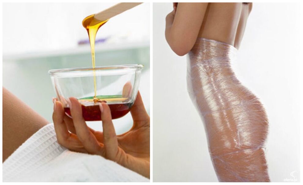 Enveloppements corporels pour perdre du poids